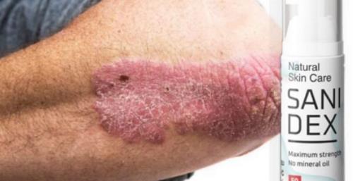 Sanidex te scapa rapid de psoriazis, ingrediente, mod de administrare